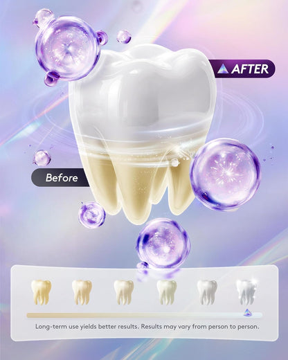 Hismile V34 Teeth Whitening Colour Corrector Serum